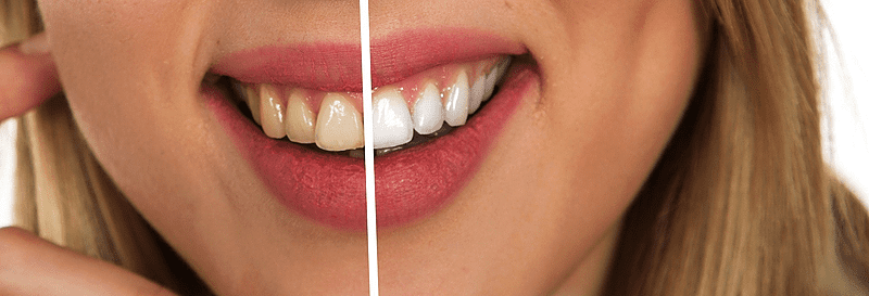 Domaća radinica: Napravite pastu za izbjeljivanje zuba