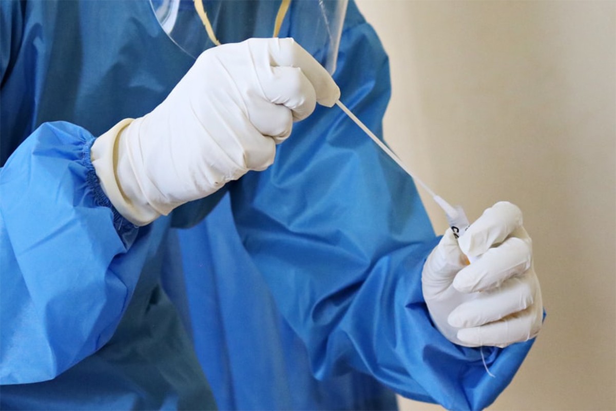 U Srpskoj 159 novozaraženih, 17 osoba preminulo