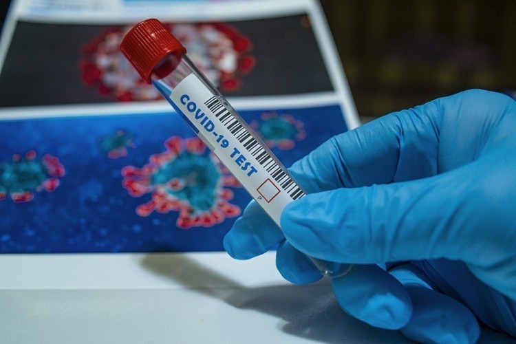 U FBiH preminulo 10 osoba, zaraženo još 324