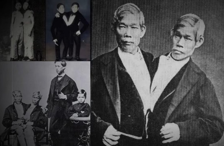 Po njima je nastao termin sijamski blizanci: Život Čanga i Enga, 'prvih' SIJAMSKIH BLIZANACA