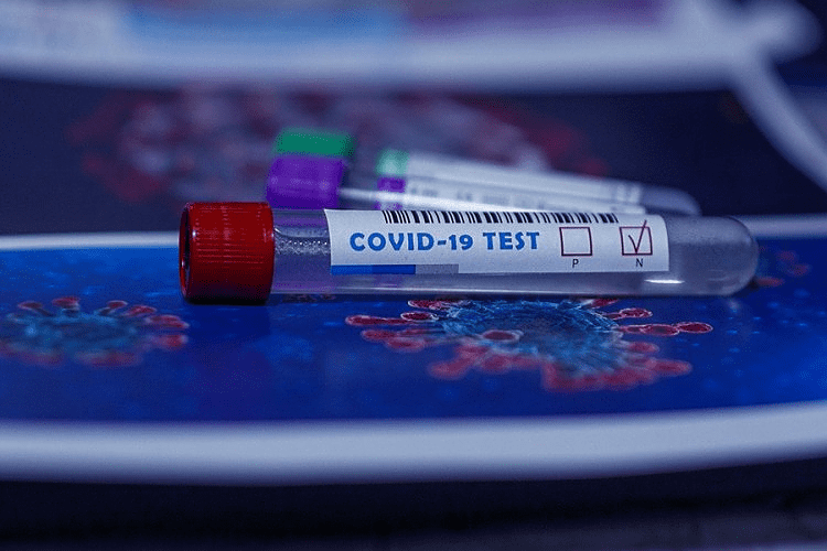 Predloženo uvođenje obaveznog negativnog PCR testa pri ulasku u BiH