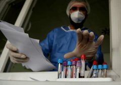 TEŽE KLINIČKE SLIKE Na udaru korone u Hrvatskoj sve mlađi ljudi