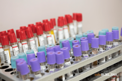 U RS još 106 oboljelih, preminulo 13 osoba