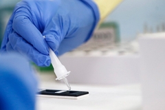 U Sloveniji najviši procenat pozitivnih testova od početka epidemije