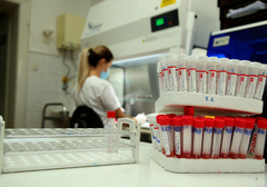 PREMINULO 10 ZARAŽENIH Na virus korona pozitivne još 154 osobe u Srpskoj