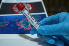 Deset osoba preminulo, još 91 pozitivno na virus korona u Srpskoj