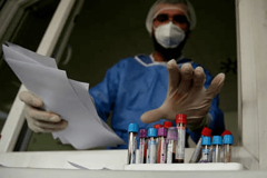 PREMINULO SEDMORO ZARAŽENIH Na korona virus pozitivne još 63 osobe u Srpskoj