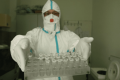 PREMINULO 15 PACIJENATA Koronom u Srpskoj zaražene još 543 osobe