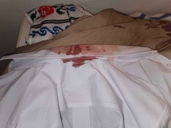 Oglasio se mladoženja kojeg su u Brčkom pretukli zbog hrvatske zastave /VIDEO/