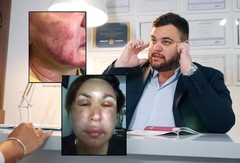 Operisao žene bez dozvole, pomagala mu majka: Optužen lažni hirurg Sava, tužilaštvo traži osam i po godina zatvora
