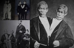 Po njima je nastao termin sijamski blizanci: Život Čanga i Enga, 'prvih' SIJAMSKIH BLIZANACA