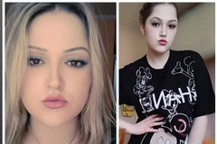 Mlada nezaposlena medicinska sestra hitno treba novac za liječenje i skupe preglede