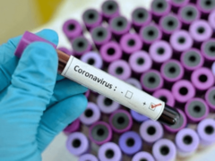 Institutu za Јavno zdravstvo Srpske 45.000 PCR testova