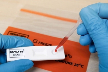 Odobren prvi srpski test na koronu, uskoro zamijena za PCR