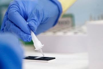 U Sloveniji najviši procenat pozitivnih testova od početka epidemije