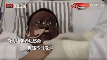 TRAUMATIČNO ISKUSTVO Kinezi nakon najtežih simptoma korone postali CRNI, a evo KAKO JE TO MOGUĆE