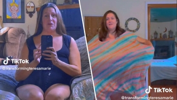 Smršala je 189 kilograma, a nedavno je uklonila i veliki višak kože: "Srećna sam i zdrava"
