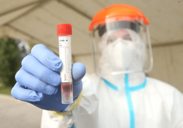PREMINULO OSAM PACIJENATA Korona virus potvrđen kod još 263 osobe u Srpskoj