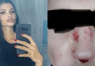 "Injekciju u nos mi je dala nasred dvorišta, stezao sam zube i plakao" Slavko je MUŠKA ŽRTVA "barbi doktorke"