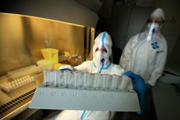 SEDMORO PREMINULIH Povećava se broj zaraženih, na koronu pozitivne još 442 osobe u Srpskoj