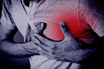 Ove 4 popularne namirnice mogu začepiti arterije i povećati rizik od srčanog udara